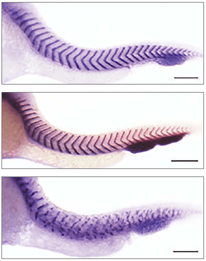 An image showing how gene pairing affects spine development.